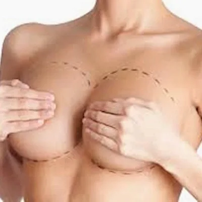 GÖĞÜS ESTETİĞİ