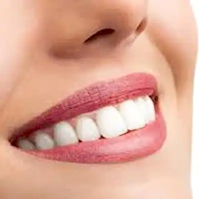 DİŞ ESTETİĞİ